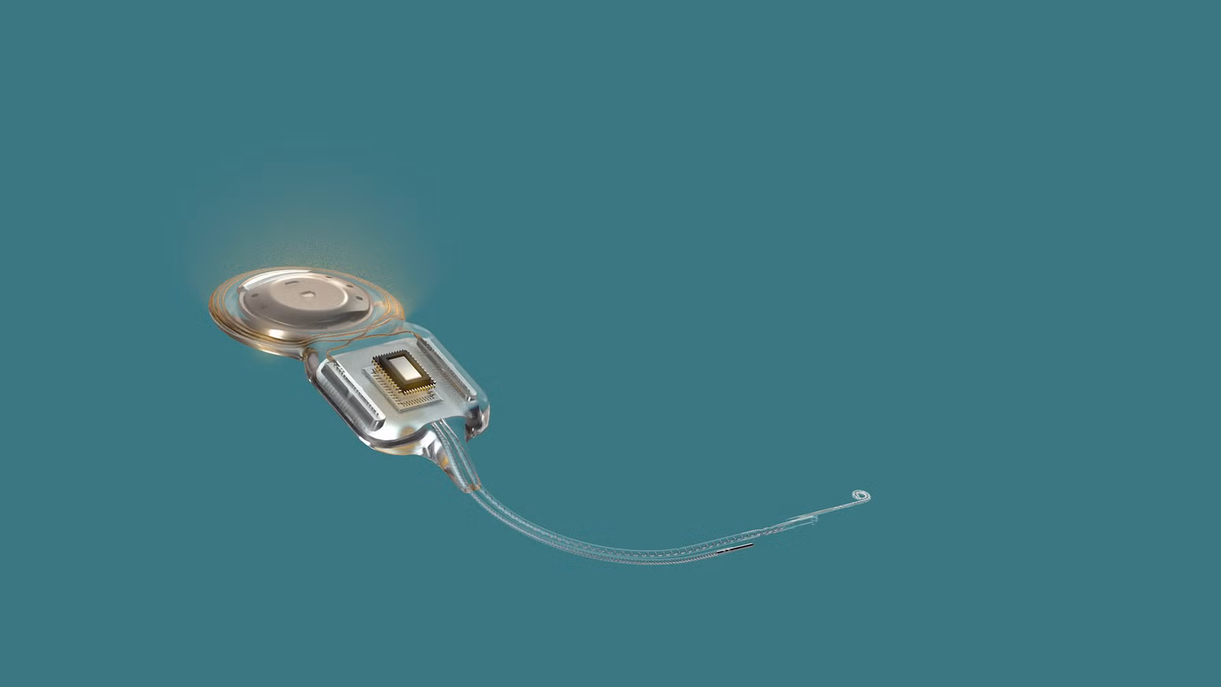 Nucleus Nexa Cochlear Implant with Auracast and Firmware Updates