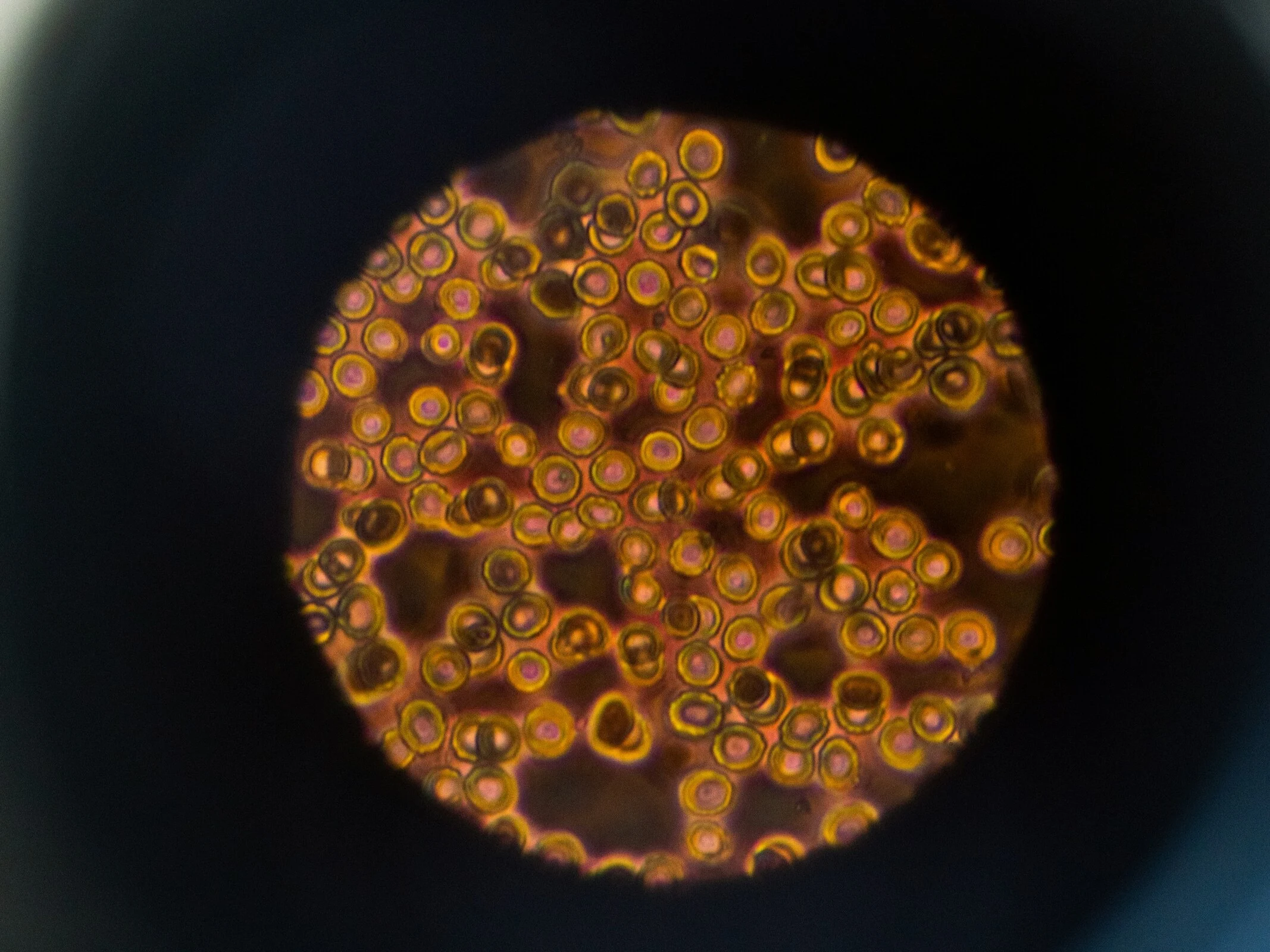 New Microscope Technology Reveals Deep Insights into Living Brain Tissue