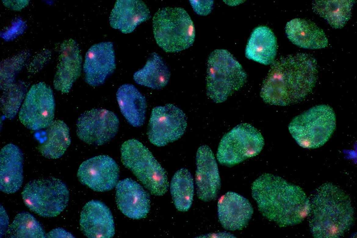 Scientists Create Self-Replicating T Cells for Cancer Treatment