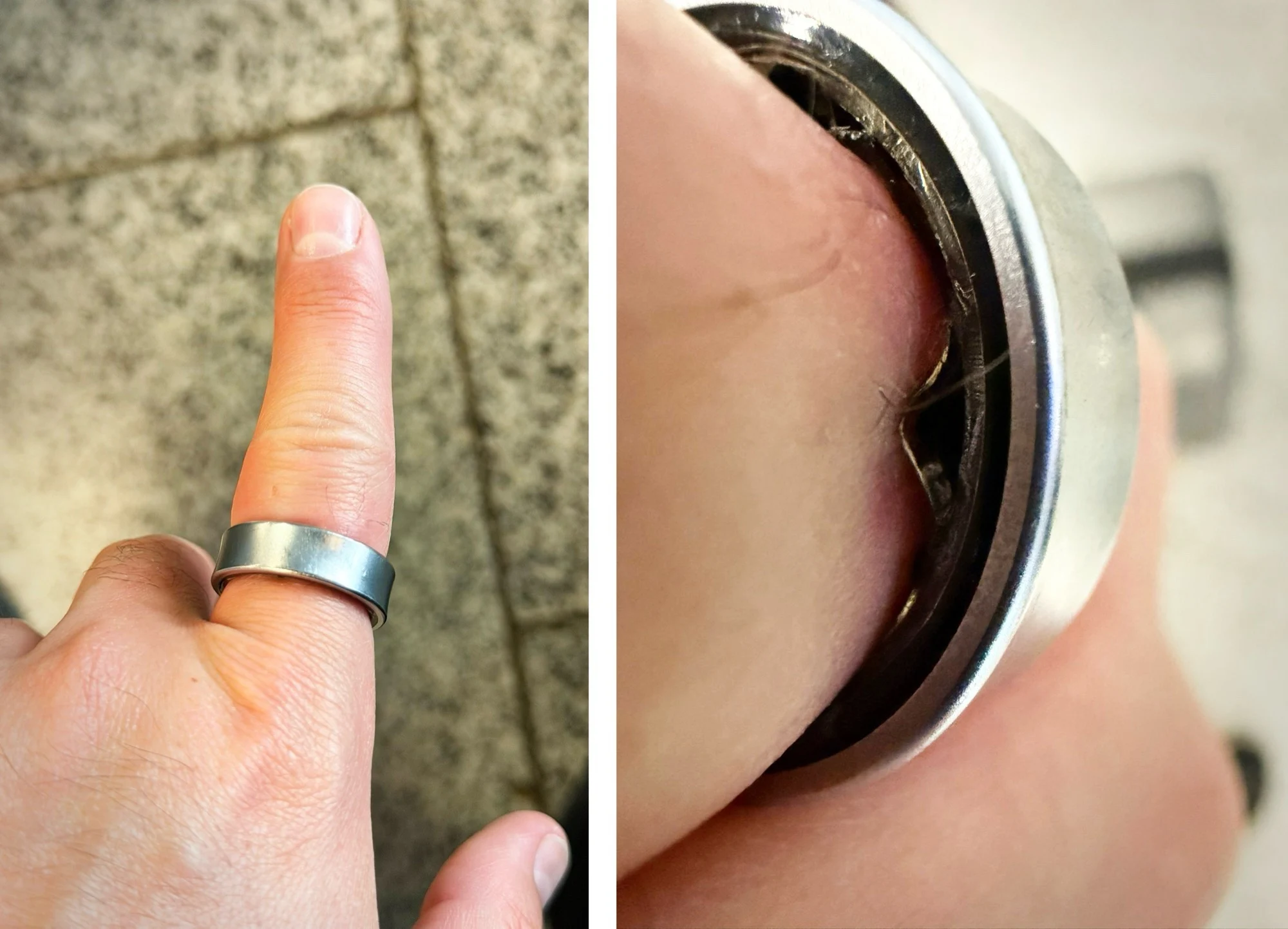Samsung Galaxy Ring Battery Swelling Causes Emergency Room Visit