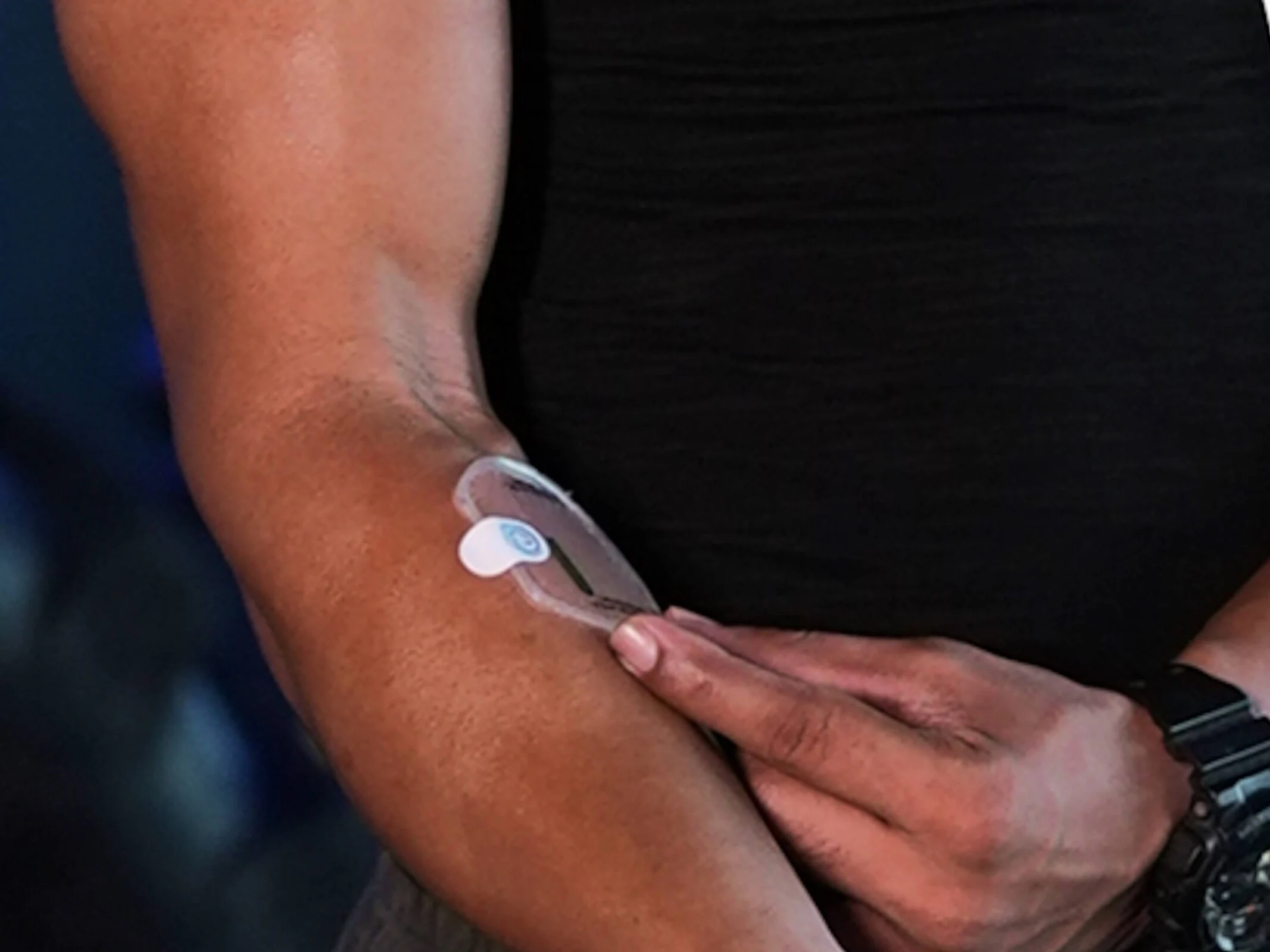 Hydrosense: Wearable Device Monitors Sweat for Fluid Loss