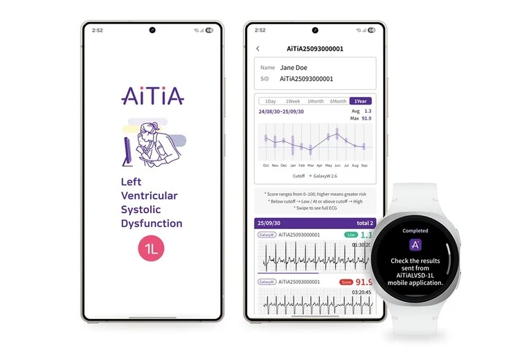 Samsung Unveils New Heart Health Feature for Smartwatches