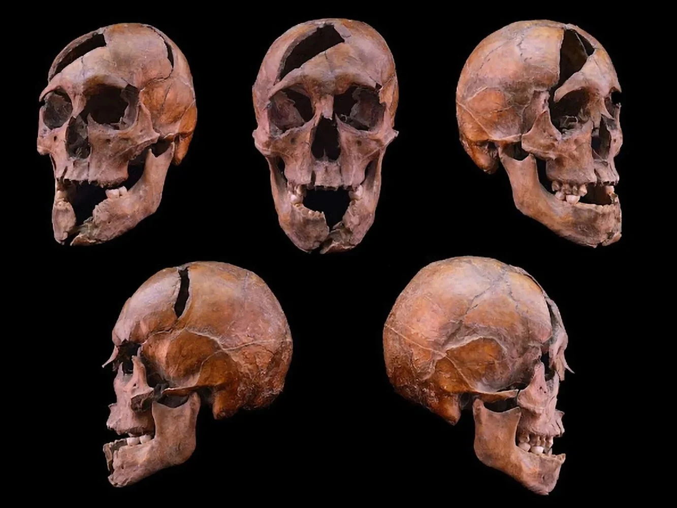 DNA Solves 700-Year Mystery of Medieval Royalty’s Identity